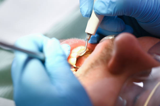 Best Urgent Dental Care for Toothache in Fairfax, CA