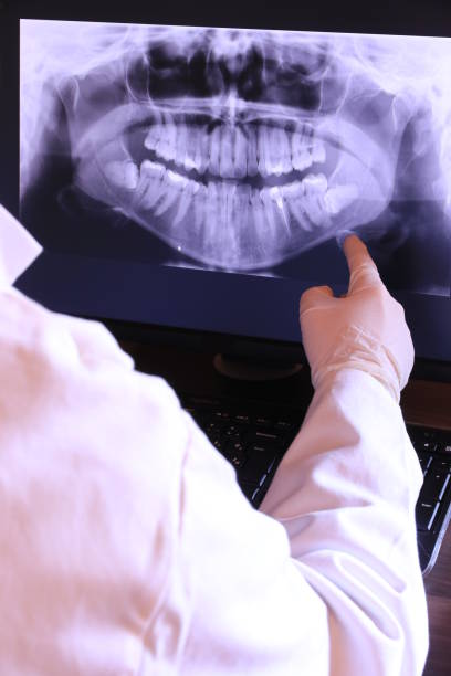 Best Emergency Dentist for Special Needs Patients in Fairfax, CA